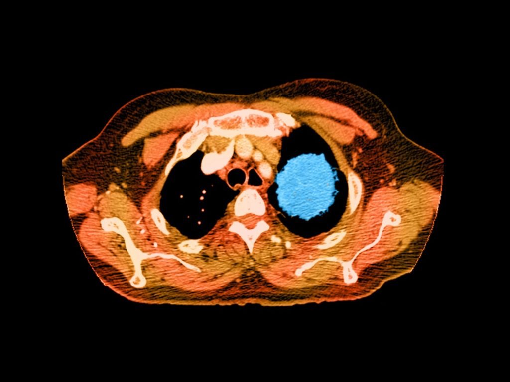 Resized Image